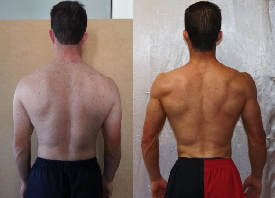 Back fat before after photo